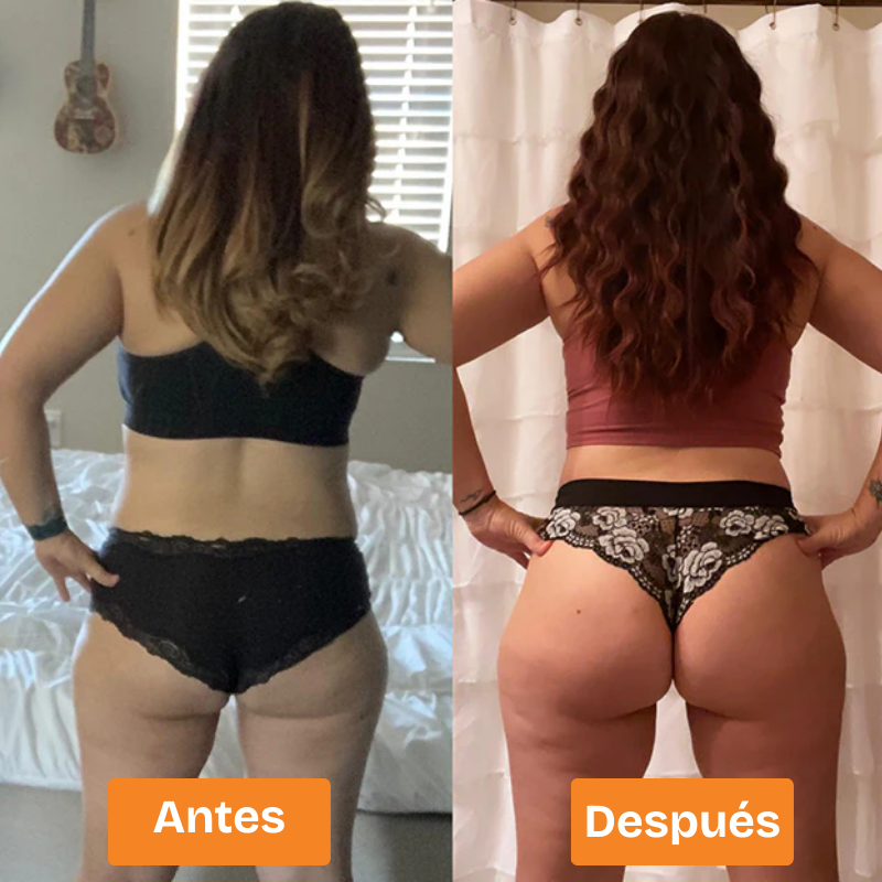 Sculptra™-Disfruta de unos glúteos firmes y perfectos con el dispositivo EMS Gluteos