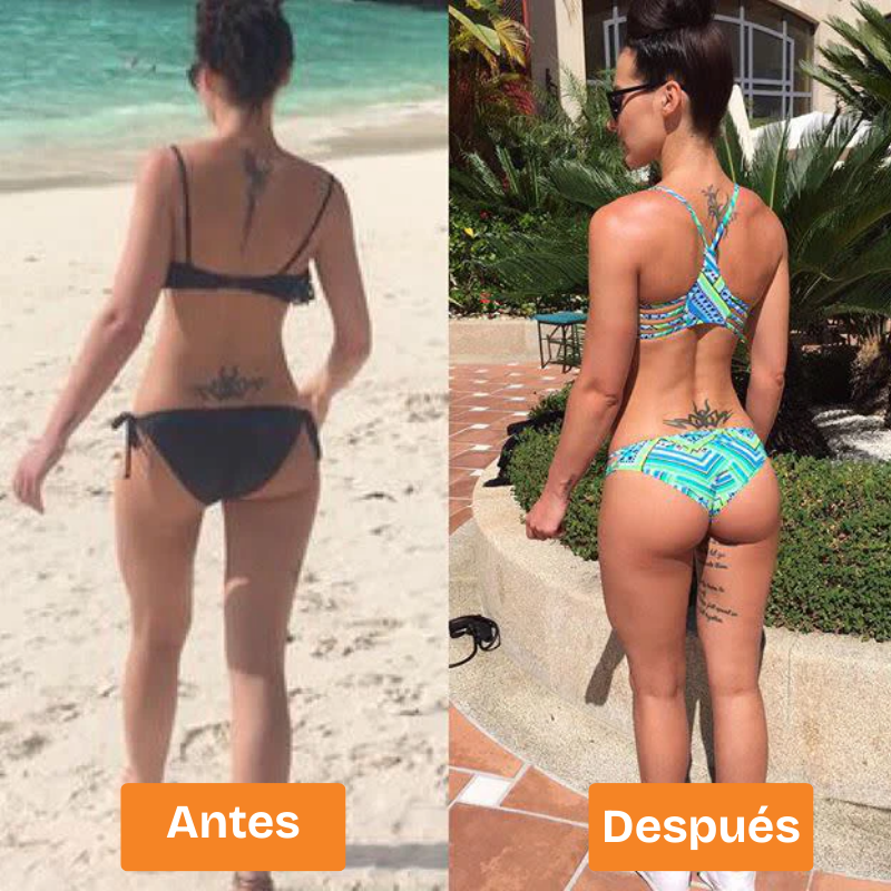 Sculptra™-Disfruta de unos glúteos firmes y perfectos con el dispositivo EMS Gluteos