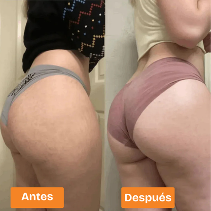 Sculptra™-Disfruta de unos glúteos firmes y perfectos con el dispositivo EMS Gluteos